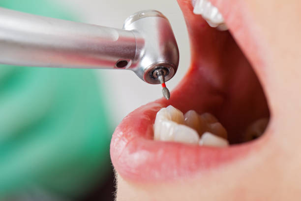 Best Knocked-Out Tooth Emergency  in Anaheim, CA